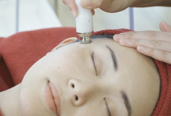 ダイヤモンドピーリング